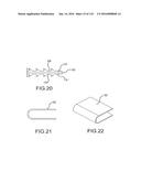 FACET JOINT IMPLANTS AND DELIVERY TOOLS diagram and image