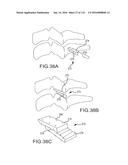 FACET JOINT IMPLANTS AND DELIVERY TOOLS diagram and image