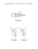 FACET JOINT IMPLANTS AND DELIVERY TOOLS diagram and image