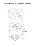 FACET JOINT IMPLANTS AND DELIVERY TOOLS diagram and image