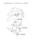 FACET JOINT IMPLANTS AND DELIVERY TOOLS diagram and image