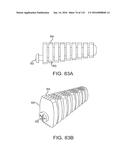 FACET JOINT IMPLANTS AND DELIVERY TOOLS diagram and image