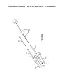 FACET JOINT IMPLANTS AND DELIVERY TOOLS diagram and image