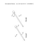 FACET JOINT IMPLANTS AND DELIVERY TOOLS diagram and image