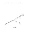 FACET JOINT IMPLANTS AND DELIVERY TOOLS diagram and image