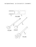 FACET JOINT IMPLANTS AND DELIVERY TOOLS diagram and image