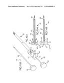 FACET JOINT IMPLANTS AND DELIVERY TOOLS diagram and image