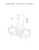 FACET JOINT IMPLANTS AND DELIVERY TOOLS diagram and image