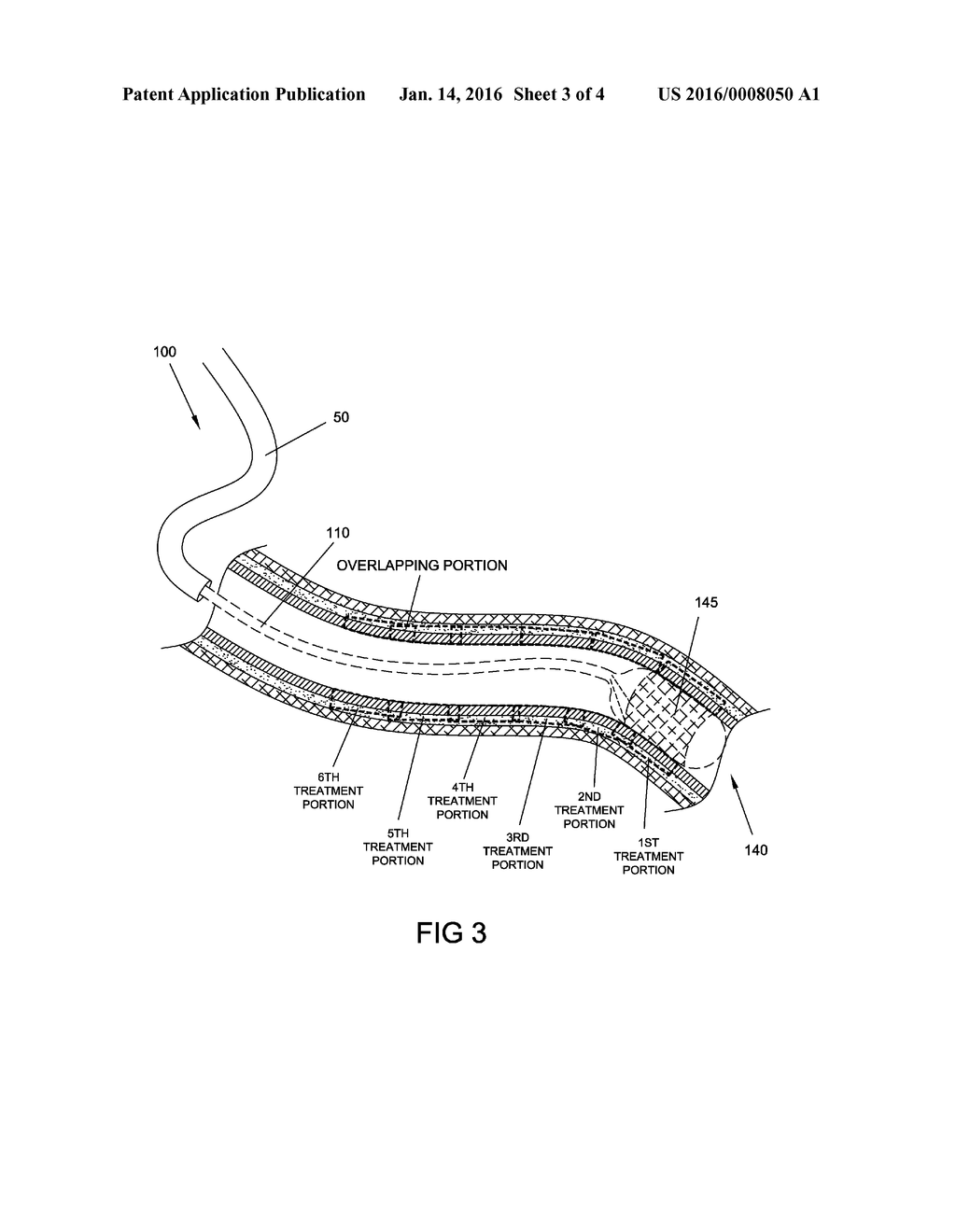 METHODS, SYSTEMS AND DEVICES FOR PERFORMING MULTIPLE TREATMENTS ON A     PATIENT - diagram, schematic, and image 04