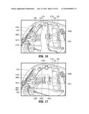 SIMPLIFIED SPRING-LOADED MECHANISM FOR DELIVERING SHAFT FORCE OF A     SURGICAL INSTRUMENT diagram and image