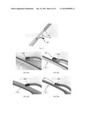 APPARATUS AND METHOD FOR SELF-GUIDED ABLATION diagram and image