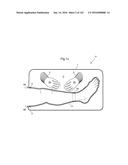 SURGICAL ASSISTING DEVICE diagram and image