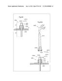 SURGICAL ASSISTING DEVICE diagram and image