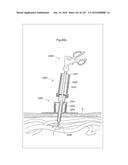 SURGICAL ASSISTING DEVICE diagram and image