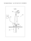 SURGICAL ASSISTING DEVICE diagram and image