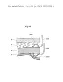 SURGICAL ASSISTING DEVICE diagram and image