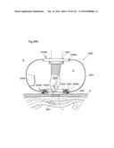 SURGICAL ASSISTING DEVICE diagram and image