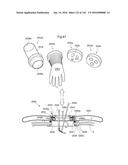 SURGICAL ASSISTING DEVICE diagram and image