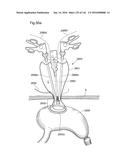 SURGICAL ASSISTING DEVICE diagram and image