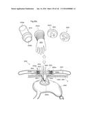 SURGICAL ASSISTING DEVICE diagram and image