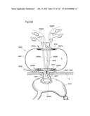 SURGICAL ASSISTING DEVICE diagram and image