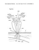 SURGICAL ASSISTING DEVICE diagram and image