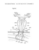 SURGICAL ASSISTING DEVICE diagram and image