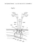 SURGICAL ASSISTING DEVICE diagram and image