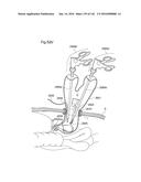 SURGICAL ASSISTING DEVICE diagram and image