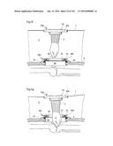 SURGICAL ASSISTING DEVICE diagram and image