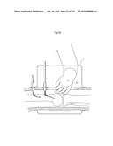 SURGICAL ASSISTING DEVICE diagram and image