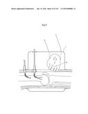 SURGICAL ASSISTING DEVICE diagram and image