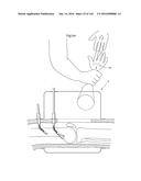 SURGICAL ASSISTING DEVICE diagram and image