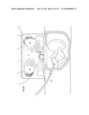 SURGICAL ASSISTING DEVICE diagram and image