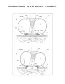 SURGICAL ASSISTING DEVICE diagram and image