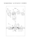 SURGICAL ASSISTING DEVICE diagram and image