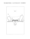 SURGICAL ASSISTING DEVICE diagram and image