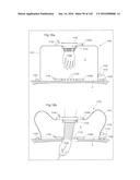 SURGICAL ASSISTING DEVICE diagram and image