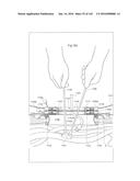 SURGICAL ASSISTING DEVICE diagram and image