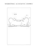 SURGICAL ASSISTING DEVICE diagram and image