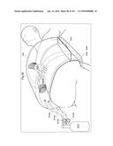 SURGICAL ASSISTING DEVICE diagram and image