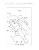 SURGICAL ASSISTING DEVICE diagram and image