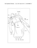 SURGICAL ASSISTING DEVICE diagram and image