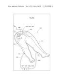 SURGICAL ASSISTING DEVICE diagram and image