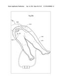 SURGICAL ASSISTING DEVICE diagram and image