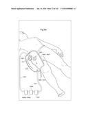 SURGICAL ASSISTING DEVICE diagram and image