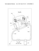 SURGICAL ASSISTING DEVICE diagram and image