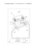 SURGICAL ASSISTING DEVICE diagram and image