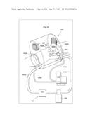 SURGICAL ASSISTING DEVICE diagram and image