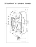 SURGICAL ASSISTING DEVICE diagram and image